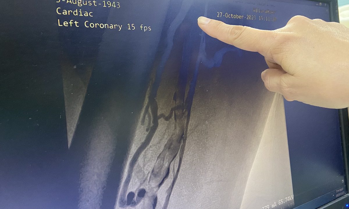 老翁車禍左腿傷口險截肢　員榮傷口、心臟外科聯手醫治能下床走路 - 早安台灣新聞 | Morning Taiwan News