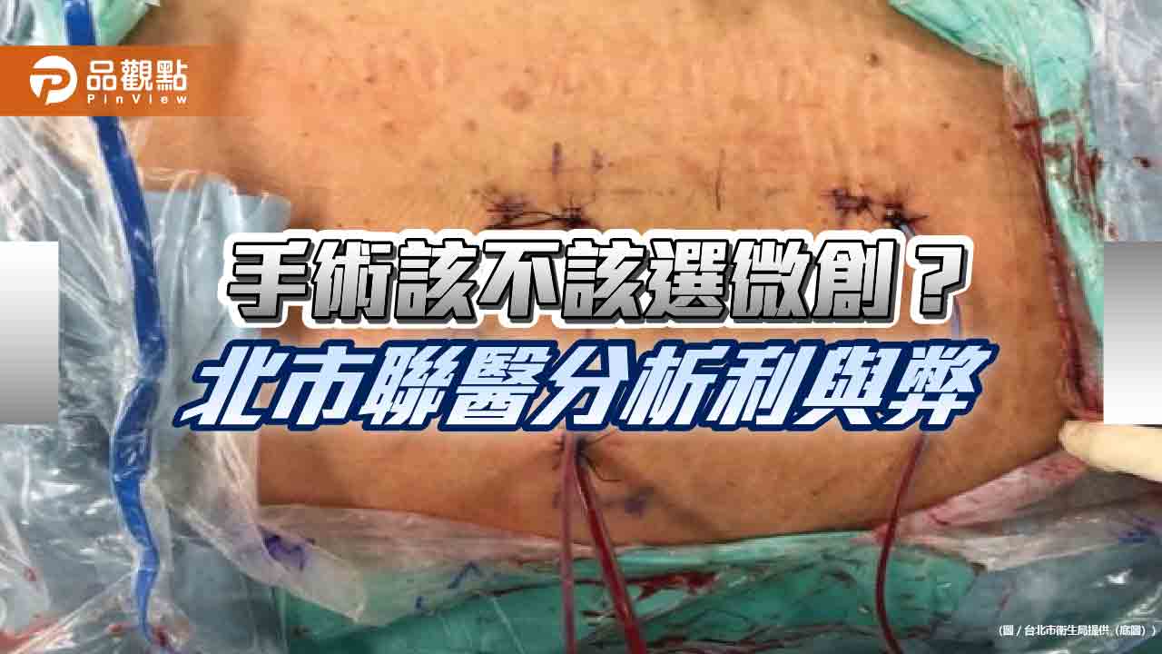 手術該不該選微創？-北市聯醫分析利與弊