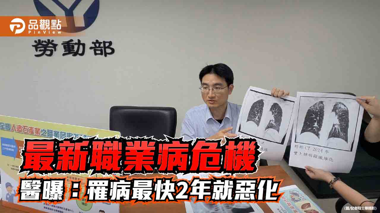 最新職業病危機-醫曝這產業罹病最快2年就惡化